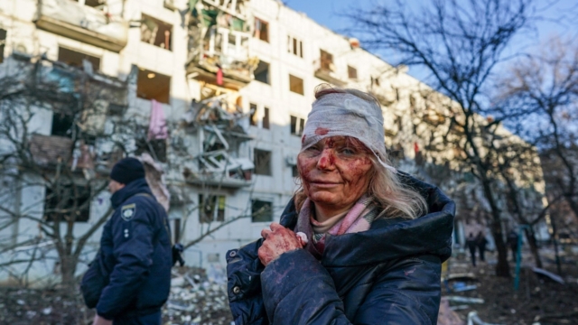 CHUHUIV, UKRAINE - FEBRUARY 24: (EDITORS NOTE: Image depicts graphic content) A wounded woman is seen after an airstrike damaged an apartment complex in city of Chuhuiv, Kharkiv Oblast, Ukraine on February 24, 2022. (Photo by Wolfgang Schwan/Anadolu Agency via Getty Images)